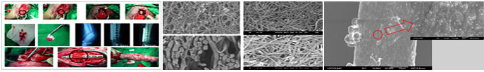 Natural polymer as biomaterial